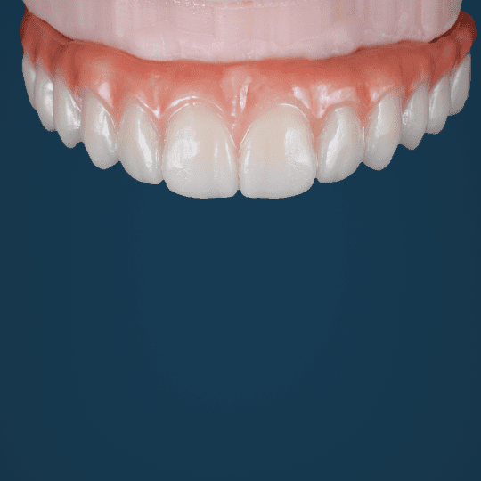 Digital Smile Design